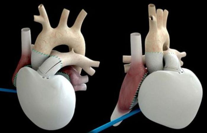 قصة أول عملية زرع قلب صناعى بالتاريخ فى ذكراها الثامنة