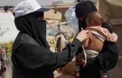 مسؤولة بأوتشا تحذر من انتشار الكوليرا وسوء تغذية الأطفال باليمن