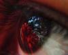 علامات في العين تكشف 8 حالات صحية خطيرة