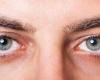 4 أعراض تكشف عن الإصابة بـ«جفاف العين»