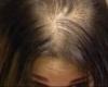 وصفة طبيعية لعلاج الشعر الخفيف وإعادة إنباتهالإثنين 25/مارس/2024 - 11:03 ص
الشعر الخفيف من المشكلات التي تعاني منها العديد من الفتيات ما يؤثر على مظهر الشعر بشكل سلبي ومظهر صاحبته.
